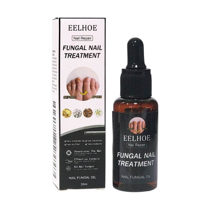 TRATAMIENTO ANTIFUNGICO REPARADOR PARA UÑAS INTENSIVO EELHOE 30ML