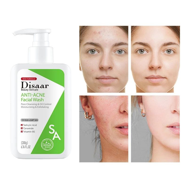JABON FACIAL ANTI ACNE LIMPIEZA DE POROS CONTROL DE GRASA DISAAR 200G