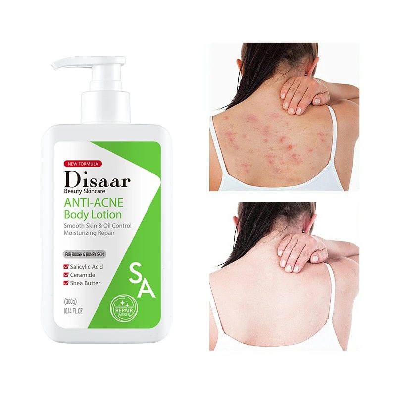 CREMA CORPORAL ANTI ACNE DISAAR 300G