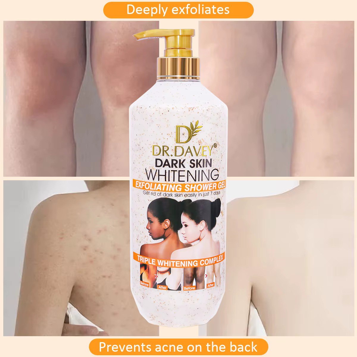 GEL DE DUCHA EXFOLIANTE BLANQUEADOR DE PIEL OSCURA DR DAVEY 1000ML
